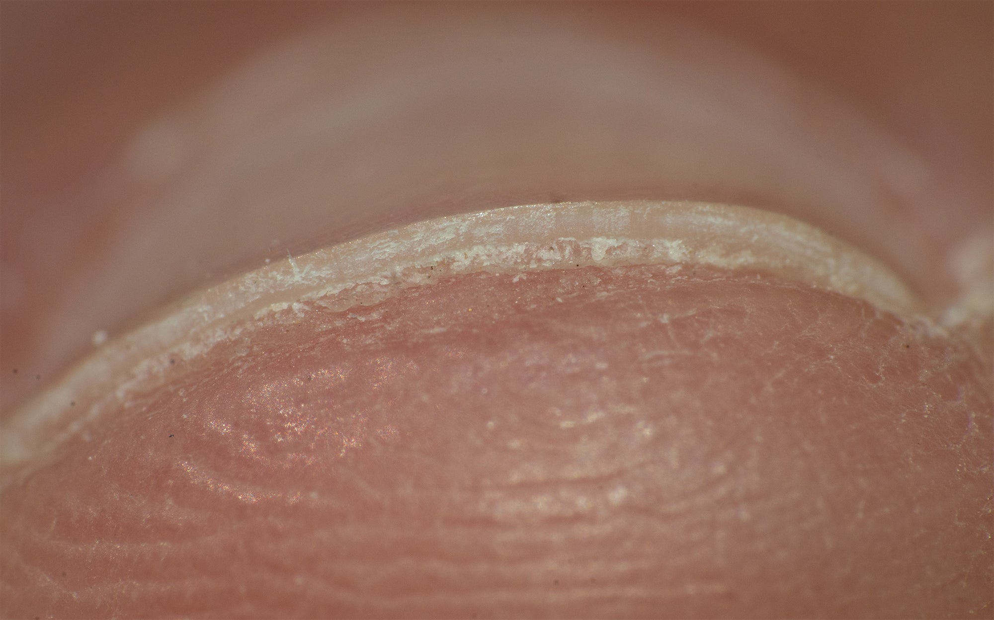 Traditional nail clippers leave your nails with a rough, fractured edge